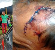 Elias Mora fue la persona que agredió al taxista, dijo la Policía. La víctima está siendo tratada en el hospital Erasmo Meoz. Cortesía