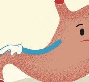 Las personas obesas  son más propensas a sufrirlo, porque tienen más tejido estomacal y su dieta no es balanceada.  Elpais.com.co