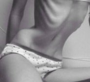 En estos trastornos la relación con el cuerpo y la comida se convierte en una forma de controlar y aliviar las propias emociones o de expresas sentimiento que no saben gestionar. Colprensa