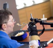 Con este dispositivo experimental, sus músculos reciben instrucciones mediante 36 electrodos implantados en su brazo y antebrazo. AFP