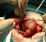 El corazón de la paciente fue ´reiniciado´ con total normalidad. FCI