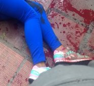 La venezolana Mary Yelithza Castillo se recupera de las heridas en el hospital Erasmo Meoz. Cortesía