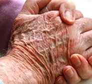 Según un estudio de la Universidad de California San Francisco. Internet / Referencial