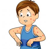 Según la Organización Mundial de la Salud (OMS). Internet