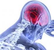 Pixabay / referencial