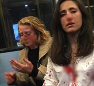 La uruguaya Melania Geymonat, de 28 años, explicó en Facebook que ella y su novia Chris (izquierda) fueron golpeadas en autobús. Tomada de Twitter