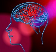 También conocido como isquemia cerebral. Se presenta cuando el cese del riego sanguíneo está causado por un coágulo que tapona un vaso sanguíneo del cerebro. También se le conoce con los nombres de trombosis o embolia. Pixabay