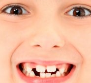 El profesional de salud orientará cómo tratar la situación sin que se torne riesgosa para el niño y sus padres. Colprensa