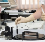 En 2018, en los países donde invierte el Fondo, 18,9 millones de personas estaban bajo tratamiento antirretroviral contra el VIH, 5,3 millones de personas eran controladas y tratadas por tuberculosis y 131 millones de mosquiteros fueron distribuidas para proteger de la malaria. Pixabay referencial