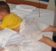 Bebé que resultó quemado con el agua caliente para las hallacas. Cortesía