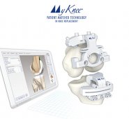 La tecnología MyKnee brinda la oportunidad de asegurar una cirugía exitosa, con una mayor duración de la prótesis y una rápida recuperación. Cortesía