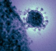 Coronavirus, partícula COVID-19. OMS