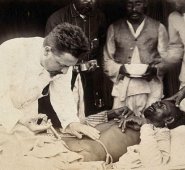 El doctor Simmonds inyectando su suero curativo en un paciente durante el brote de la peste bubónica en Karachi, India. Fotografía de 1897. Wikipedia