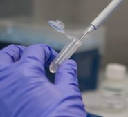 Estas pruebas permiten la optimización de recursos en la lucha contra la propagación del virus- Cortesía