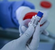 Se  han identificado 10 compuestos químicos comúnmente utilizados como principios activos en la formulación de medicamentos.  Colprensa