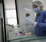 Pruebas Coronavirus Colprensa