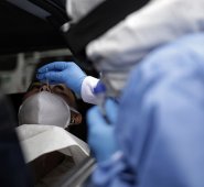 Este fenómeno se ha evidenciado en los casos leves, moderados y asintomáticos. Colprensa