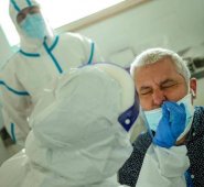 La pérdida de olfato es un síntoma frecuente entre los pacientes con COVID-19. Colprensa.