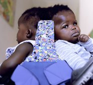 Por primera vez en Italia, y probablemente en el mundo, un equipo de cirujanos logró separar a gemelas unidas por la cabeza. AFP