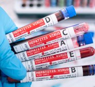 Las EPS se lavan las manos y no quieren ejecutar las acciones de búsqueda de estas personas para hacerles la carga viral o la confirmación de la prueba, según La Asociación Nortesantandereana de Hepatitis Virales. Freepik.es