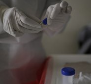 Los investigadores señalaron que los virus son parásitos que no pueden replicarse solos, de modo que toman el control de las células humanas para lograr esa tarea. Colprensa
