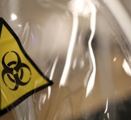 El primer caso de reinfección se conoció hace pocos días en Hong Kong. Colprensa