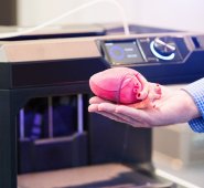 La utilización de modelos 3D digitales o modelos impresos en 3D puede ser decisiva en la definición del tratamiento de los pacientes. Cortesía