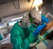 Los cerebros de tres pacientes que murieron por complicaciones graves relacionadas con el coronavirus mostraron rastros del virus, en diversos grados. Colprensa