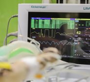 Una enfermedad cardiovascular es un trastorno en el corazón y los vasos sanguíneos debido a obstrucciones en el flujo de sangre de las venas y las arterias. Pixabay reference