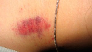 El joven habitante de Iztapalapa tenía una novia de 25 años. Internet | Referencial