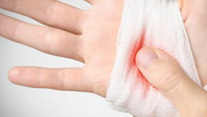 La hemofilia se diagnostica tomando una muestra de sangre. Internet