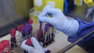 La mejor estrategia para combatir el virus de la inmunodeficiencia humana, según Onusida, es la promoción de la responsabilidad entre todos los habitantes. Colprensa