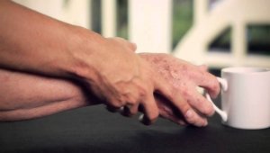 La app consiste en un software que captura el movimiento del paciente por medio del Kinect, dispositivo que viene con la consola de juegos Xbox. Internet