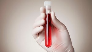 Se estima que unos 36,9 millones de personas viven en la actualidad con el virus del VIH. Internet