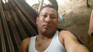 Luis Alfredo Contreras fue torturado, baleado y le regaron ácido en el rostro. Cortesía