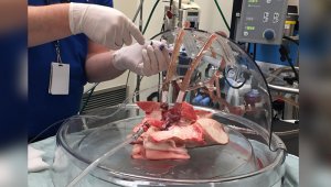 A la fecha, se han hecho pruebas con pacientes, de los cuales dos lograron la eliminación de virus y en ocho, se redujo significativamente. EFE