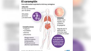 África es la región más afectada por el aumento de casos. AFP