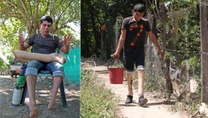 Los ángeles sí existen. De esto está seguro Jaime Alonso, a quien la vida le puso una prueba difícil a sus tres meses de nacido, cuando un marrano se le comió los pies. Mario Caicedo y cortesía