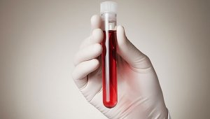 Exámenes de sangre. Colprensa