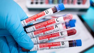 Las EPS se lavan las manos y no quieren ejecutar las acciones de búsqueda de estas personas para hacerles la carga viral o la confirmación de la prueba, según La Asociación Nortesantandereana de Hepatitis Virales. Freepik.es