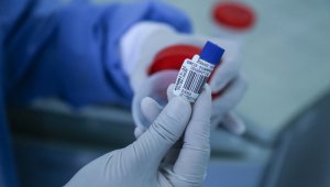 5.507 pruebas pendientes por los resultados. Archivo