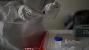 Ese número indica el porcentaje de la población que ha tenido contacto con la enfermedad y es un referente para entender el comportamiento del virus. Colprensa