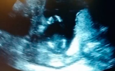 Los padres de este bebé captaron la reacción del niño mientras le cantaban, lo cual los asombró. (Foto tomada de internet)