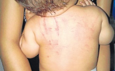 Según Carlos Gutiérrez, psicólogo de familia, los niños están quedando en medio de los conflictos familiares de los adultos y el error está en que los infantes sean el trofeo, porque el padre que se siente desplazado termina maltratando al pequeño.  La Opinión