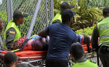 El ciclista Hugo Barrete sufrió el accidente durante los entrenamientos de la mañana de este martes en la Copa Mundo de Ciclismo que se cumple en Cali. Colprensa
