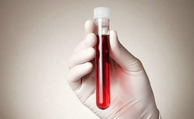 Lucha contra el VIH. Colprensa