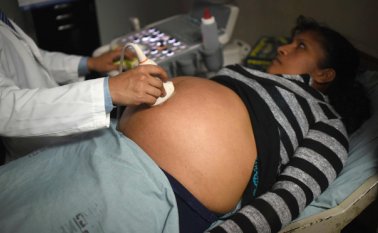 La ONU hizo un llamado a los países afectados con zika a dar acceso a métodos anticonceptivos y el aboroto. AFP