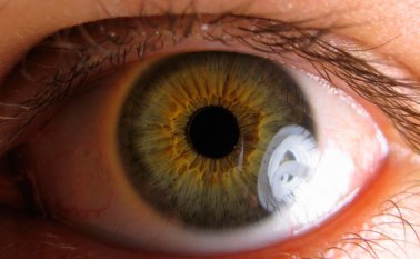 Los resultados de una posible relación entre el virus del zika y problemas oculares aparecieron en la edición electrónica de la revista médica JAMA Ophthalmology. Internet | Refencial