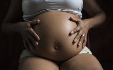 En Brasil descubren virus del zika en el cerebro de los bebés. AP