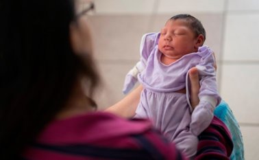 Bebé con microcefalia. Lahora.gt